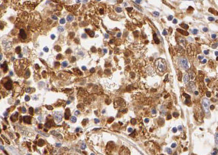 Immunohistochemistry THUMPD3 Antibody - BSA Free