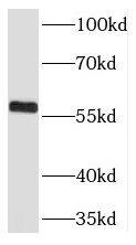 Western Blot: THUMPD3 Antibody - BSA Free [NBP3-45243] - HeLa cells were subjected to SDS PAGE followed by western blot with (THUMPD3 antibody) at dilution of 1:2000