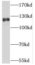 Western Blot: THRAP3 Antibody - BSA Free [NBP3-45245] - HeLa cells were subjected to SDS PAGE followed by western blot with (THRAP3 antibody) at dilution of 1:500