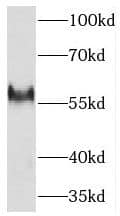 Western Blot: THNSL2 Antibody - BSA Free [NBP3-45249] - HeLa cells were subjected to SDS PAGE followed by western blot with (THNSL2 antibody) at dilution of 1:1000