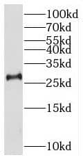 Western Blot: THAP2 Antibody - BSA Free [NBP3-45252] - HEK-293 cells were subjected to SDS PAGE followed by western blot with (THAP2 antibody) at dilution of 1:600