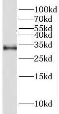 Western Blot: THAP10 Antibody - BSA Free [NBP3-45253] - HeLa cells were subjected to SDS PAGE followed by western blot with (THAP10 Antibody) at dilution of 1:300