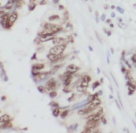 Immunohistochemistry THAP1 Antibody - BSA Free