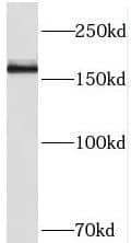 Western Blot THADA Antibody - BSA Free