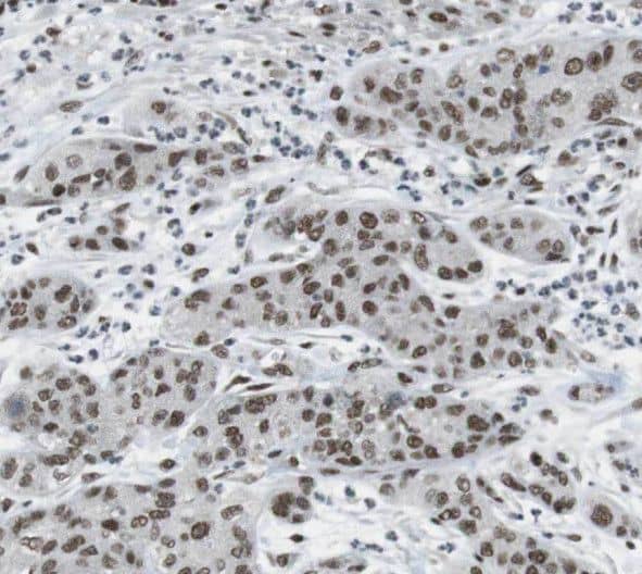 Immunohistochemistry THADA Antibody - BSA Free