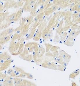Immunohistochemistry: Transglutaminase 5 Antibody - BSA Free [NBP3-45256] - Immunohistochemistry of paraffin-embedded mouse heart tissue slide using ( Transglutaminase 5 Antibody) at dilution of 1:50