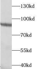Western Blot Transglutaminase 5 Antibody - BSA Free