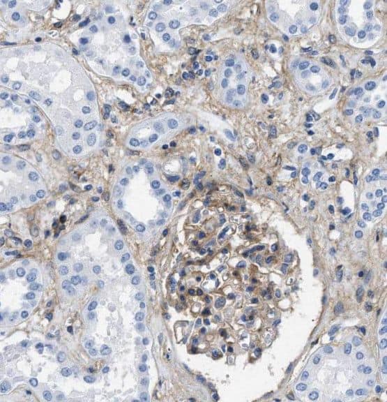 Immunohistochemistry: TGFBRAP1 Antibody - BSA Free [NBP3-45257] - Immunohistochemistry of paraffin-embedded human kidney tissue slide using (TGFBRAP1 Antibody) at dilution of 1:50