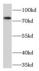 Western Blot: TGFBRAP1 Antibody - BSA Free [NBP3-45257] - HEK-293 cells were subjected to SDS PAGE followed by western blot with (TGFBRAP1 antibody) at dilution of 1:300