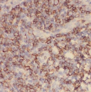 Immunohistochemistry TFPT Antibody - BSA Free