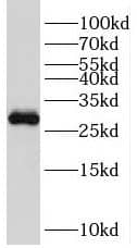 Western Blot TFPT Antibody - BSA Free