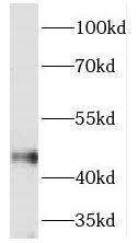 Western Blot: TEX28 Antibody - BSA Free [NBP3-45261] - Human testis tissue were subjected to SDS PAGE followed by western blot with (TEX28 antibody) at dilution of 1:500