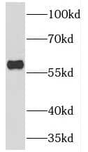 Western Blot: TESPA1 Antibody - BSA Free [NBP3-45267] - A431 cells were subjected to SDS PAGE followed by western blot with (TESPA1 antibody) at dilution of 1:1000