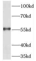 Western Blot: TEKT5 Antibody - BSA Free [NBP3-45269] - COLO 320 cells were subjected to SDS PAGE followed by western blot with ( TEKT5 Antibody) at dilution of 1:1000