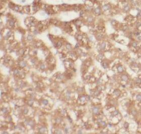 Immunohistochemistry TCTN2 Antibody - BSA Free