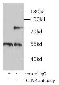 Immunoprecipitation TCTN2 Antibody - BSA Free