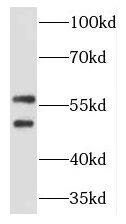 Western Blot TCP11 Antibody - BSA Free