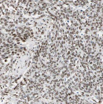 Immunohistochemistry TCEAL7 Antibody - BSA Free