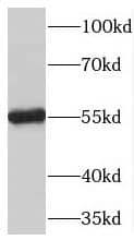 Western Blot: TBX15 Antibody - BSA Free [NBP3-45282] - HeLa cells were subjected to SDS PAGE followed by western blot with (TBX15 Antibody) at dilution of 1:600