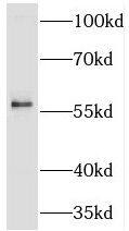 Western Blot: TBL1 Antibody - BSA Free [NBP3-45285] - Mouse pancreas tissue were subjected to SDS PAGE followed by western blot with (TBL1 antibody) at dilution of 1:400