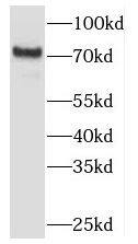 Western Blot TBC1D23 Antibody - BSA Free