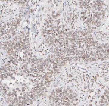 Immunohistochemistry TAF7 Antibody - BSA Free