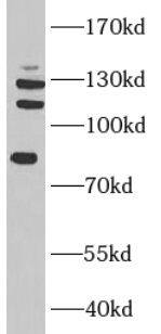 Western Blot: TAF3 Antibody - BSA Free [NBP3-45298] - Hela cells were subjected to SDS PAGE followed by western blot with (TAF3 antibody) at dilution of 1:500