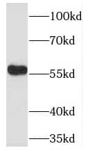 Western Blot: ADA2 beta Antibody - BSA Free [NBP3-45300] - K-562 cells were subjected to SDS PAGE followed by western blot with (ADA2 beta antibody) at dilution of 1:1000