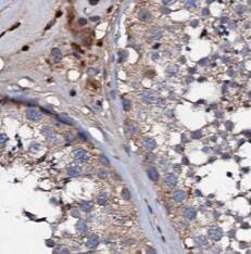 Immunohistochemistry TADA1L Antibody - BSA Free