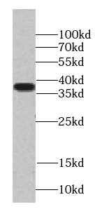 Western Blot TADA1L Antibody - BSA Free