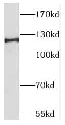 Western Blot: TACC1 Antibody - BSA Free [NBP3-45304] - MCF7 cells were subjected to SDS PAGE followed by western blot with (TACC1 antibody) at dilution of 1:1000