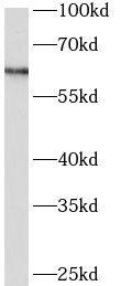 Western Blot Arylsulfatase D Antibody - BSA Free
