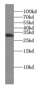 Western Blot: Syntaxin 3 Antibody - BSA Free [NBP3-45309] - SH-SY5Y cells were subjected to SDS PAGE followed by western blot with ( Syntaxin 3 antibody) at dilution of 1:1000