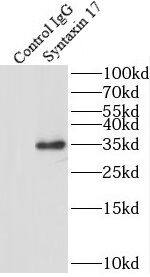 Immunoprecipitation: STX17 Antibody - BSA Free [NBP3-45310] - IP Result of anti-Syntaxin 17 (IP:, 4ug; Detection: 1:1000) with HepG2 cells lysate 3600ug.