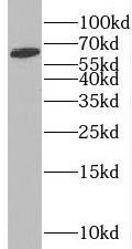 Western Blot: SLC38A1 Antibody - BSA Free [NBP3-45312] - Jurkat cells were subjected to SDS PAGE followed by western blot with (SLC38A1 antibody) at dilution of 1:500