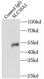 Immunoprecipitation: SLC38A1 Antibody - BSA Free [NBP3-45312] - IP Result of anti-SLC38A1 (IP:, 4ug; Detection: 1:500) with mouse brain tissue lysate 4000ug.