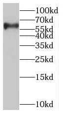Western Blot glycerol-3-phosphate permease Antibody - BSA Free