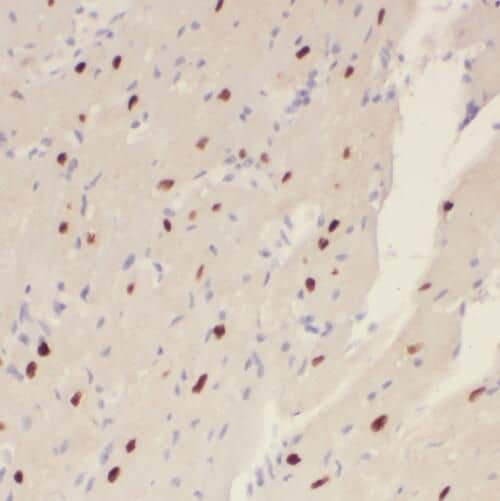Immunohistochemistry: SLC25A15 Antibody - BSA Free [NBP3-45328] - Immunohistochemistry of paraffin-embedded human heart using (SLC25A15 antibody) at dilution of 1:50