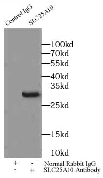 Immunoprecipitation: SLC25A10 Antibody - BSA Free [NBP3-45329] - IP Result of anti-SLC25A10 (IP: , 3ug; Detection:  1:800) with mouse liver tissue lysate 3000ug.