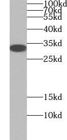Western Blot: SLC25A10 Antibody - BSA Free [NBP3-45329] - Mouse liver tissue were subjected to SDS PAGE followed by western blot with (SLC25A10 antibody) at dilution of 1:600