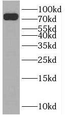 Western Blot: SLC24A4 Antibody - BSA Free [NBP3-45332] - HeLa cells were subjected to SDS PAGE followed by western blot with (SLC24A4 antibody) at dilution of 1:1000