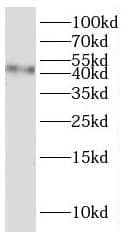 Western Blot Sialin/SLC17A5 Antibody - BSA Free