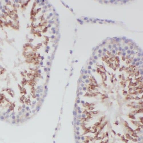 Immunohistochemistry: SLC16A12 Antibody - BSA Free [NBP3-45339] - Immunohistochemistry of paraffin-embedded human testis using (SLC16A12 antibody) at dilution of 1:50