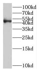Western Blot: SKAR Antibody - BSA Free [NBP3-45346] - HeLa cells were subjected to SDS PAGE followed by western blot with (SKAR antibody) at dilution of 1:500
