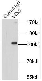 Immunoprecipitation SIX5 Antibody - BSA Free