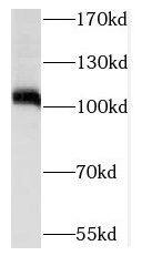 Western Blot SIX5 Antibody - BSA Free