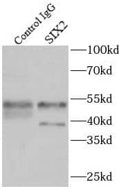 Immunoprecipitation: SIX2 Antibody - BSA Free [NBP3-45348] - IP Result of anti-SIX2 (IP:, 3ug; Detection: 1:500) with HEK-293 cells lysate 2700ug.