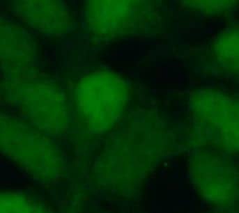 Immunocytochemistry/ Immunofluorescence: SIX2 Antibody - BSA Free [NBP3-45348] - Immunofluorescent analysis of HEK293 cells using (SIX2 Antibody) at dilution of 1:50 and Alexa Fluor 488-conjugated Goat Anti-Rabbit IgG(H+L)