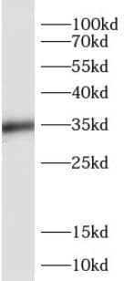 Western Blot: SIX1 Antibody - BSA Free [NBP3-45349] - A2780 cells were subjected to SDS PAGE followed by western blot with (SIX1 antibody) at dilution of 1:800