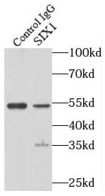 Immunoprecipitation: SIX1 Antibody - BSA Free [NBP3-45349] - IP Result of anti-SIX1 (IP:, 3ug; Detection: 1:1000) with HEK-293 cells lysate 2560ug.